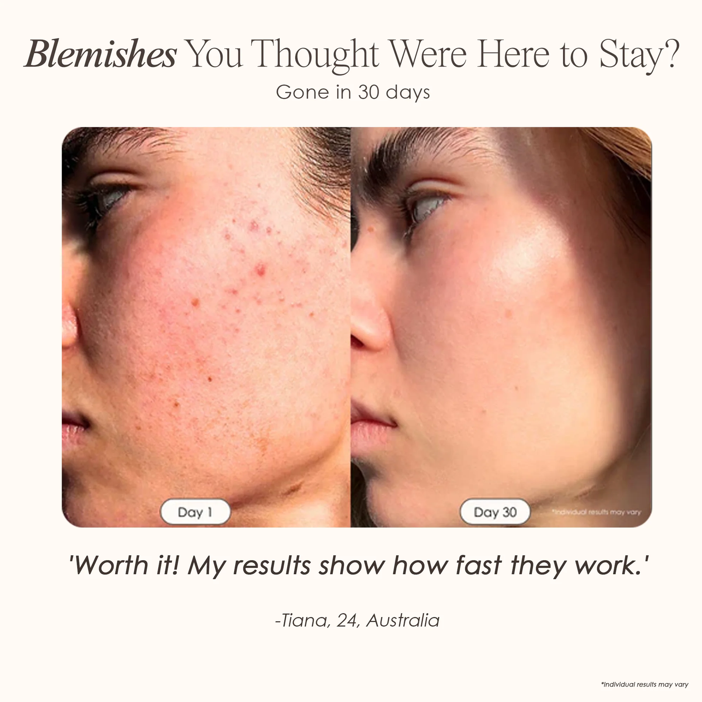 Lumalux Dome | Face & Body LED Red Light Therapy Device