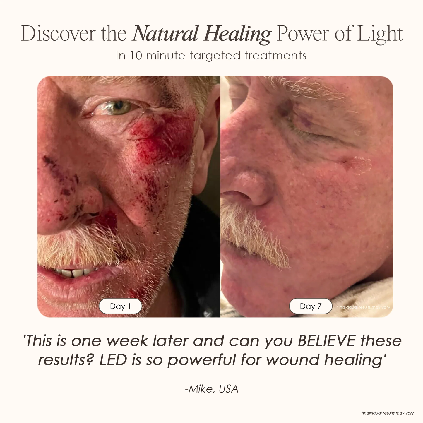 Lumalux Dome | Face & Body LED Red Light Therapy Device